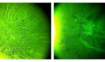 Fertile-Focus ferning pattern