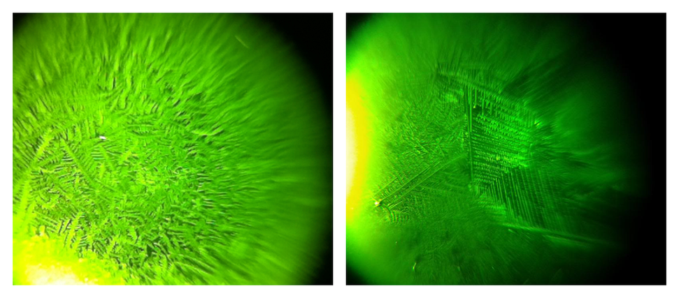 Fertile-Focus ferning pattern